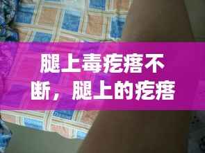 腿上毒疙瘩不断,腿上的疙瘩特别特别多为什么