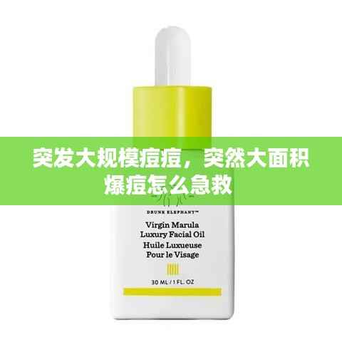 突发大规模痘痘,突然大面积爆痘怎么急救
