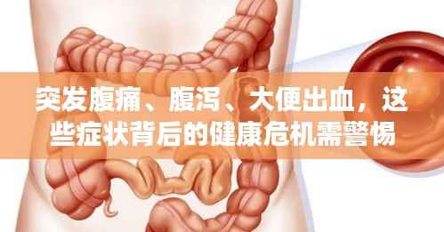 突发腹痛、腹泻、大便出血，这些症状背后的健康危机需警惕！