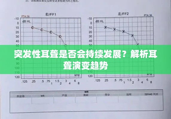 突发性耳聋是否会持续发展?解析耳聋演变趋势